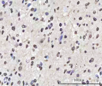 Sam68/KHDRBS1 Antibody