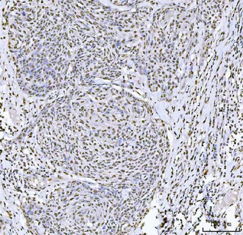 Sam68/KHDRBS1 Antibody