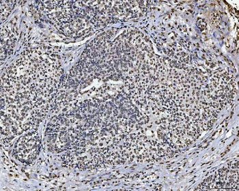 Sam68/KHDRBS1 Antibody