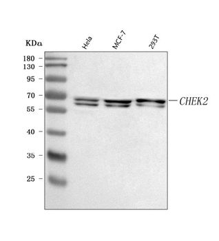 CHEK2 Rabbit Polyclonal Antibody