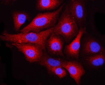 NEK6 Rabbit Polyclonal Antibody
