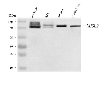 NHSL2 Rabbit Polyclonal Antibody