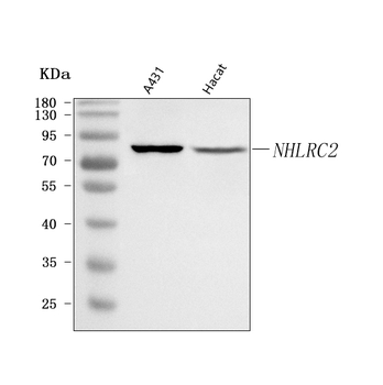 NHLRC2 Rabbit Polyclonal Antibody