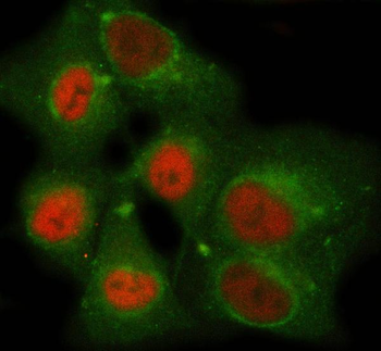 SDCCAG1/NEMF Rabbit Polyclonal Antibody