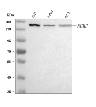 SDCCAG1/NEMF Rabbit Polyclonal Antibody