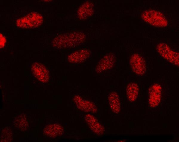 NECAB1 Rabbit Polyclonal Antibody