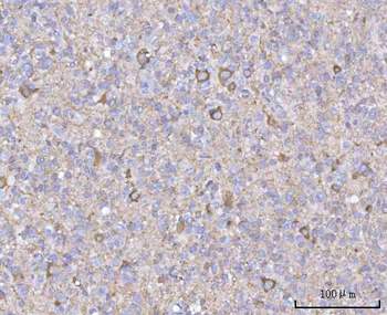 NECAB1 Rabbit Polyclonal Antibody