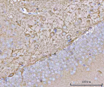 NECAB1 Rabbit Polyclonal Antibody