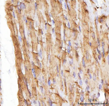 NEBL Rabbit Polyclonal Antibody
