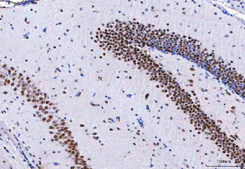 NCBP1 Antibody