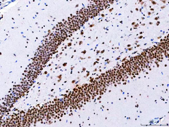 NCBP1 Antibody