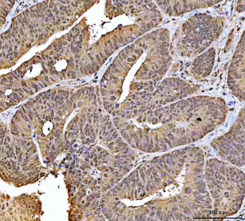 NCBP1 Antibody