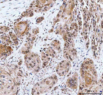 NCBP1 Antibody