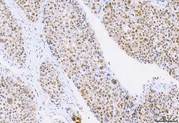 NCBP1 Antibody