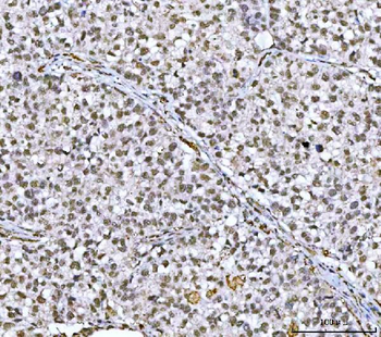 NCBP1 Antibody