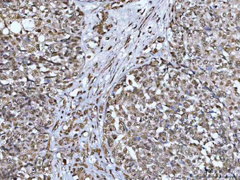 NCBP1 Antibody