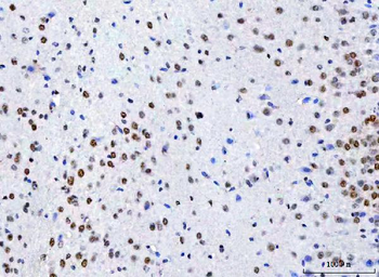 NCBP1 Antibody