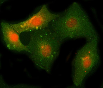 NCAPH Rabbit Polyclonal Antibody