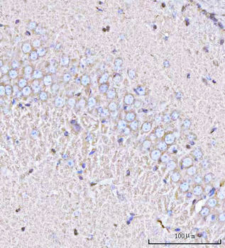 PPP3R1 Antibody