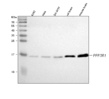 PPP3R1 Antibody