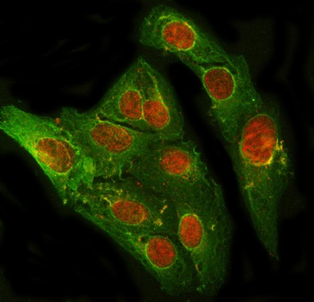 PRDM2 Rabbit Polyclonal Antibody
