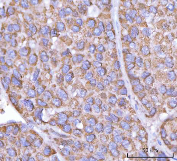 PFKFB1 Rabbit Polyclonal Antibody