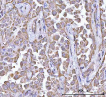 PFKFB1 Rabbit Polyclonal Antibody