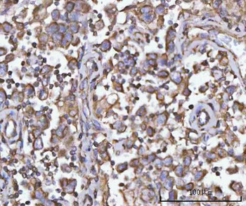 PFKFB1 Rabbit Polyclonal Antibody
