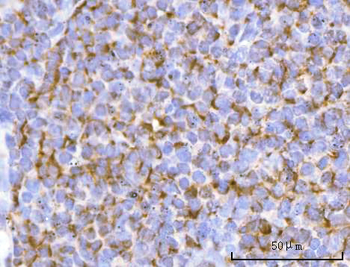 PFKFB1 Rabbit Polyclonal Antibody