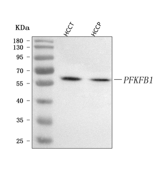 PFKFB1 Rabbit Polyclonal Antibody