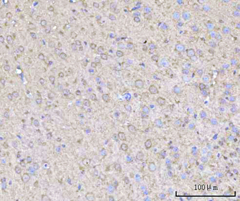 RPH3A Rabbit Polyclonal Antibody