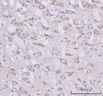 RPH3A Rabbit Polyclonal Antibody