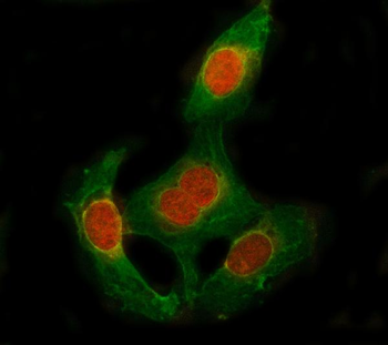 SESN1 Rabbit Polyclonal Antibody