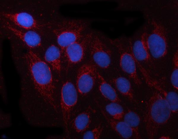 PRUNE1 Rabbit Polyclonal Antibody