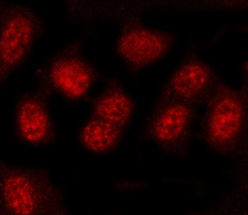 PRDM4 Rabbit Polyclonal Antibody
