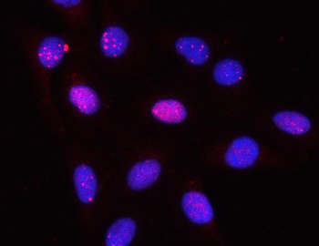 PPP2R3A Rabbit Polyclonal Antibody