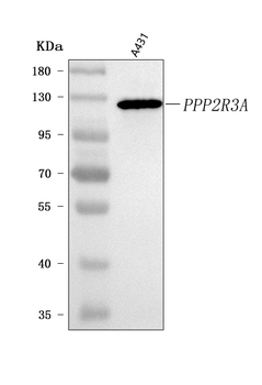PPP2R3A Rabbit Polyclonal Antibody