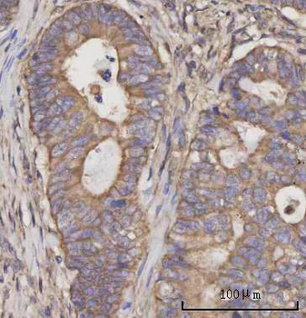 SCLY Antibody
