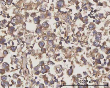 SCLY Antibody
