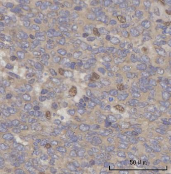 SCLY Antibody
