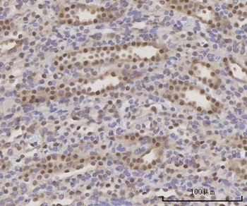 SCLY Antibody