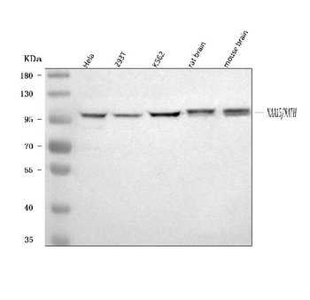 NARG1/NAA15 Rabbit Polyclonal Antibody