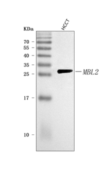 MBL2 Rabbit Polyclonal Antibody