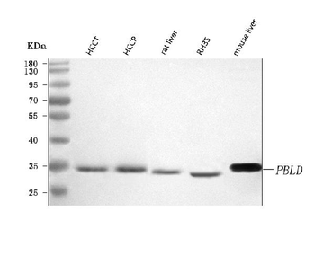 PBLD Rabbit Polyclonal Antibody