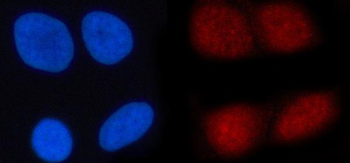 N4BP1 Antibody
