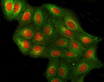 PRPF4 Rabbit Polyclonal Antibody