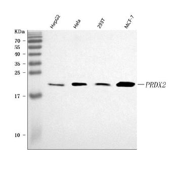 peroxiredoxin 2/PRDX2 Rabbit Polyclonal Antibody