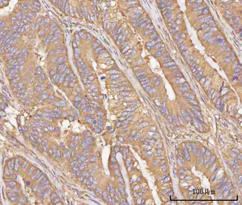 PPP3CB Rabbit Polyclonal Antibody