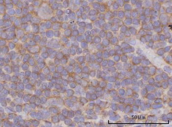 PPP3CB Rabbit Polyclonal Antibody