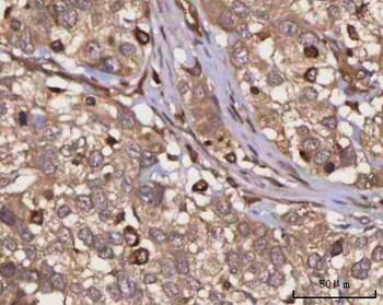 PPP3CB Rabbit Polyclonal Antibody